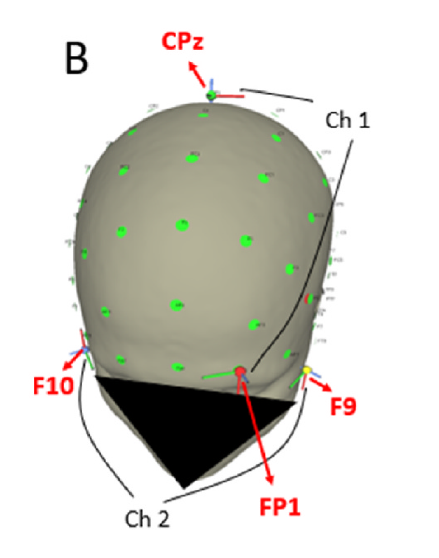 Illustration of temporal interference neurostimulation